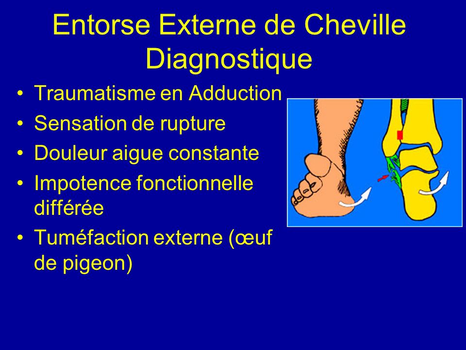 SEMIOLOGIE ARTICULAIRE ppt t l charger